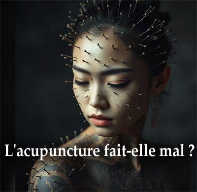 est-ce que acupuncture fait mal