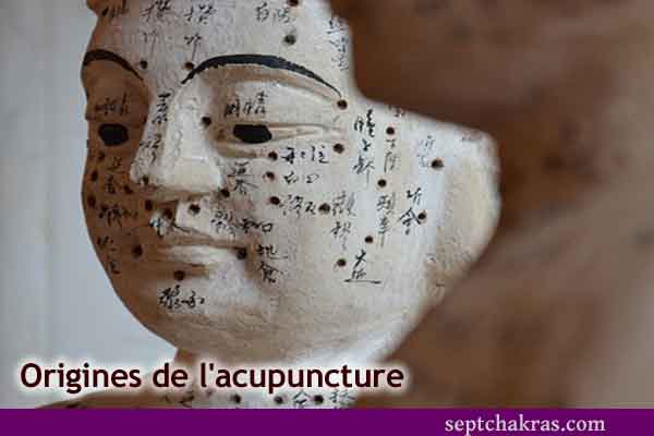 Origines de l’acupuncture